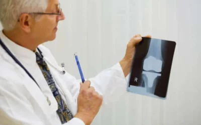 Are You Thinking Of Getting Knee Or Hip Replacement Surgery? Ask Yourself These Three Questions First